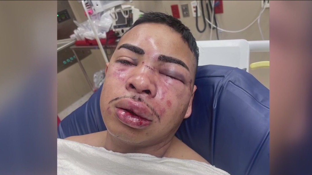 Harris County Detention Officer attacked inside jail