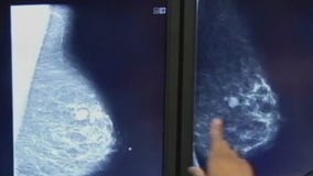 Study claims breast cancer tumors may differ based on race