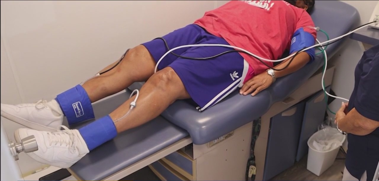 Preventing and treating peripheral artery disease