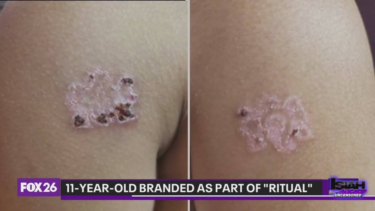 11-year-old branded as part of 'ritual'