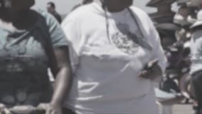 Complexities of obesity