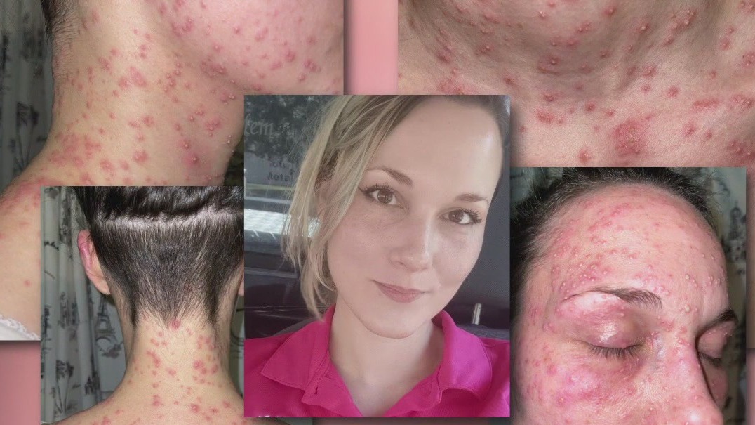 Houston-area woman speaks out after filing lawsuit