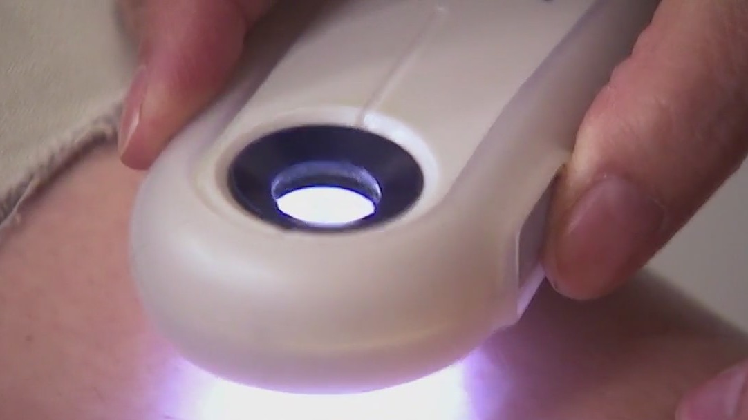 How to prep for skin cancer screening