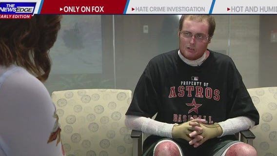 Houston area man who burned 90% of body out of ICU