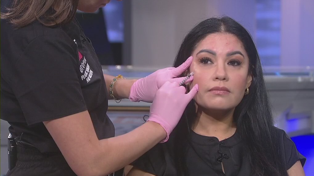 The Collab: Trends and tips in Botox