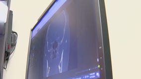 How diabetes can impact your eyesight