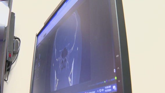 How diabetes can impact your eyesight