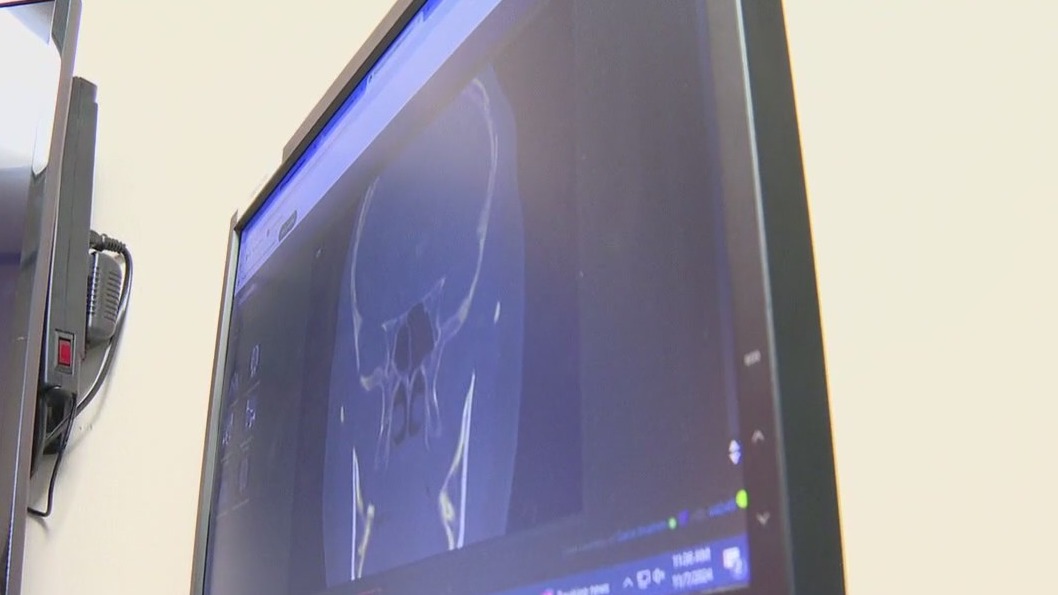 How diabetes can impact your eyesight