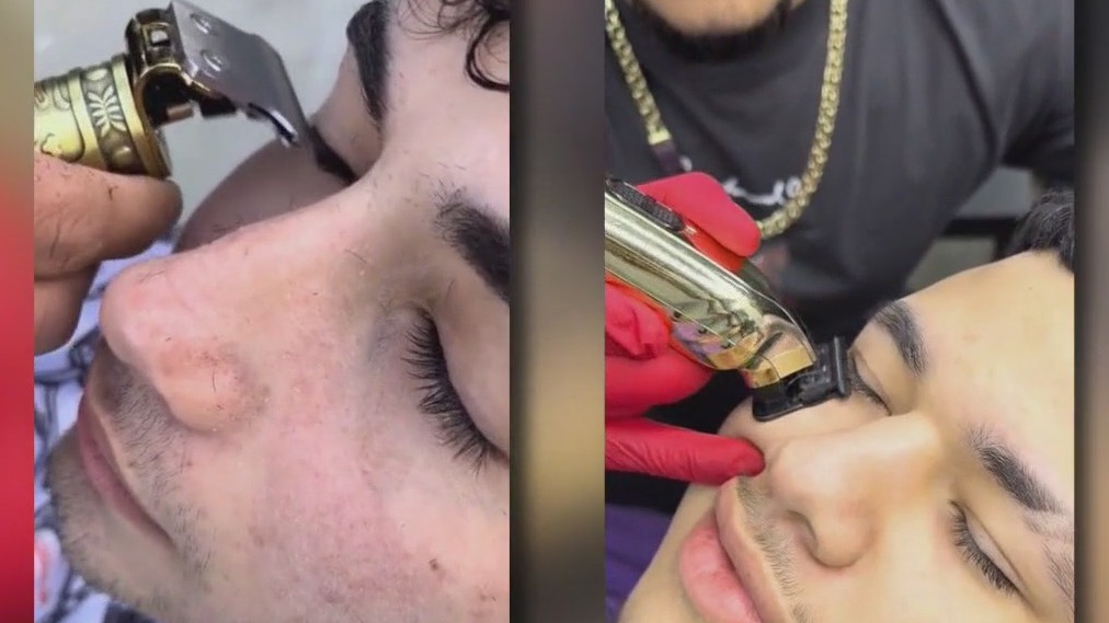 Health experts warn against men trimming their eyelashes