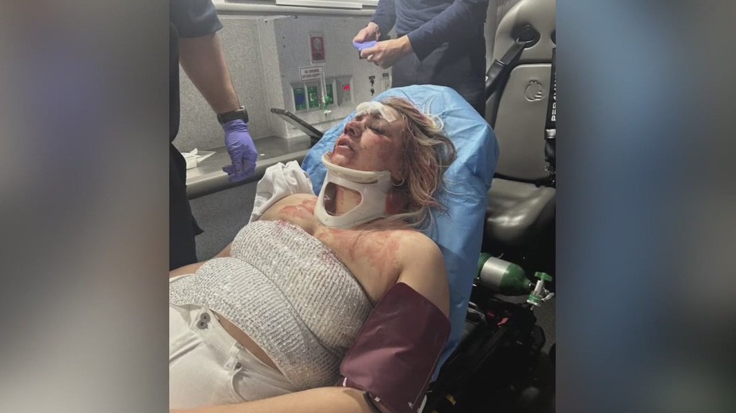 Oklahoma bride-to-be attacked in Dallas