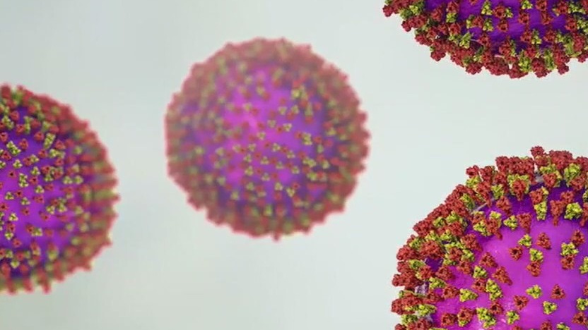 Houston: Measles case confirmed in Hobby Airport traveler