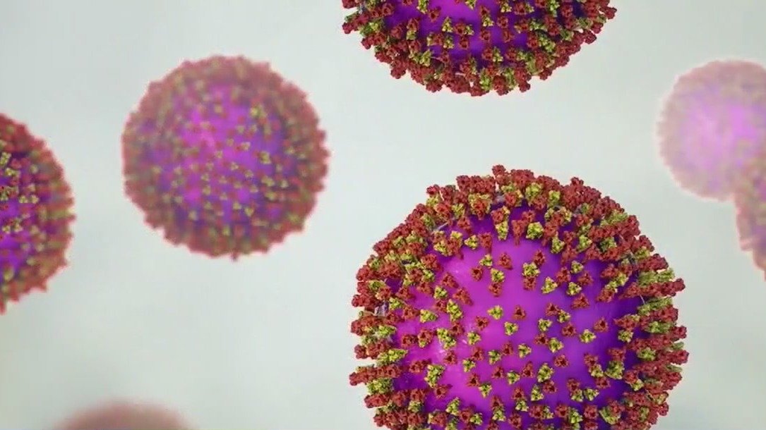 Texas measles outbreak 2025: Second child death reported | FOX 26 Houston