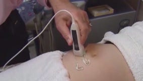 Bill to clarify Texas abortion law | What's Your Point?