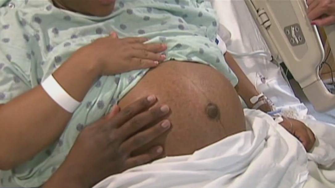 Preeclampsia Awareness Month: Explaining the disorder