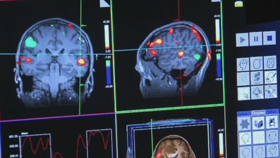 New drug shows promise reversing Alzheimer's