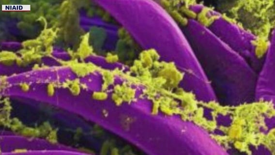 Arizona doctor addresses plague concerns