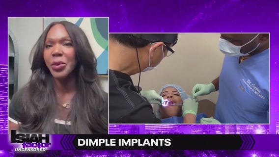 Growing interest in dimple implant surgery