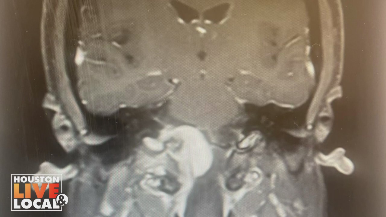 Houston raid, woman suing for brain tumor, 'Making Texas Healthier,' and more