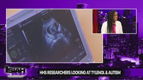 Researchers study Tylenol and autism