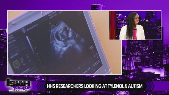 Researchers study Tylenol and autism