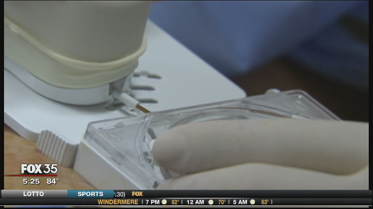 New way to zap cellulite