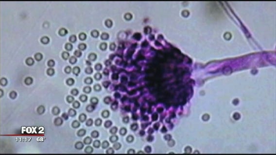 Meningitis B vaccine: Why it's here and who should get it