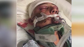 Community holds fundraiser for San Pedro teen recovering from beating