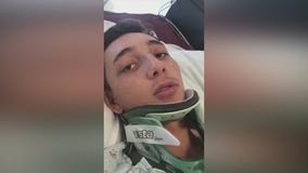 Heroes describe how they saved San Pedro teen after brutal gang beating