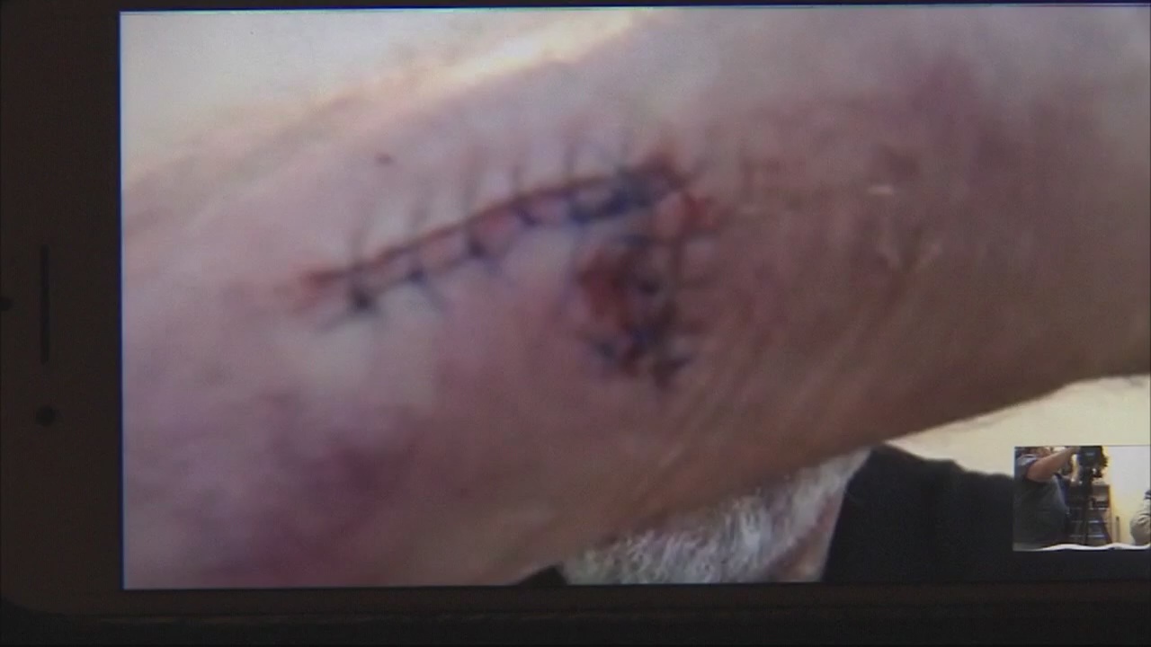 Actor attacked by panhandler in Malibu