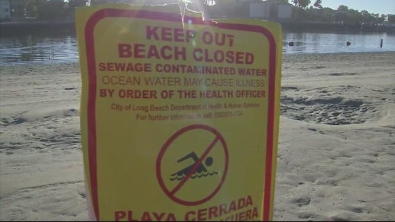 Sewage spill closes beaches near Alamitos Bay in Long Beach