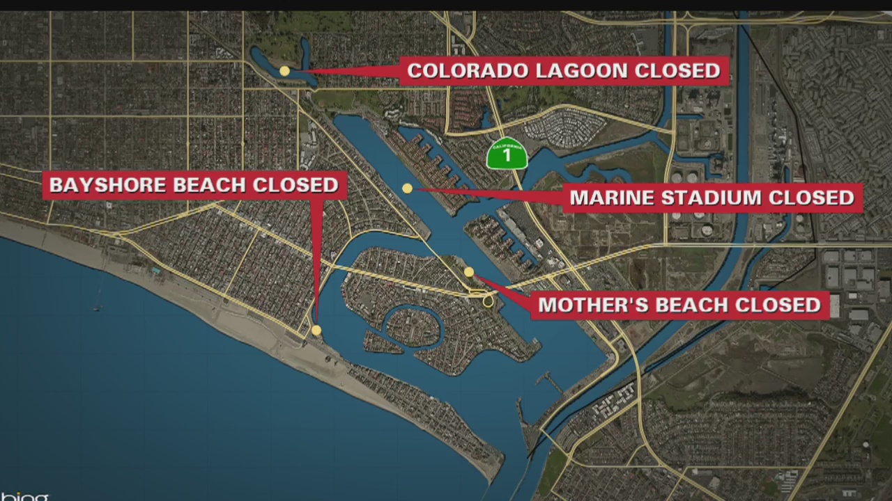 Sewage spill closes beaches near Alamitos Bay in Long Beach