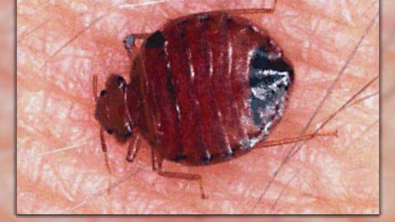 Recent bed bug infestation makes Long Beach residents restless