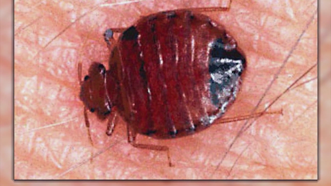 Recent bed bug infestation makes Long Beach residents restless