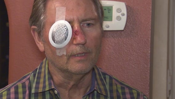 Man seriously injured in drive-by paint ball attack in Torrance