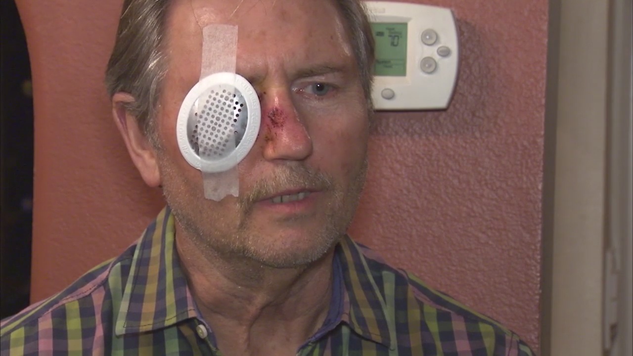 Man seriously injured in drive-by paint ball attack in Torrance