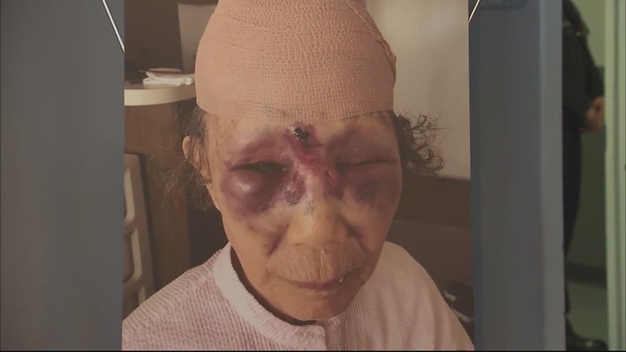 Suspect sought in brutal attack on 86-year-old grandmother