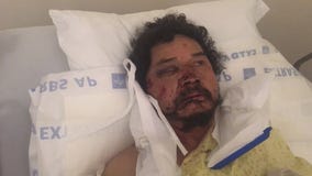 Suspects sought after street vendors attacked in South LA