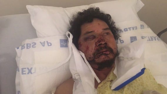 Suspects sought after street vendors attacked in South LA