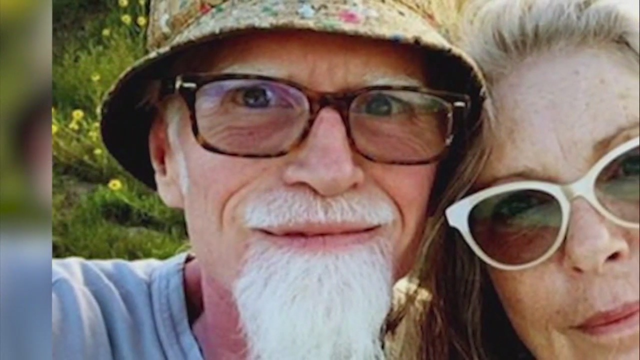 Malibu artist severely beaten, hospitalized in induced coma