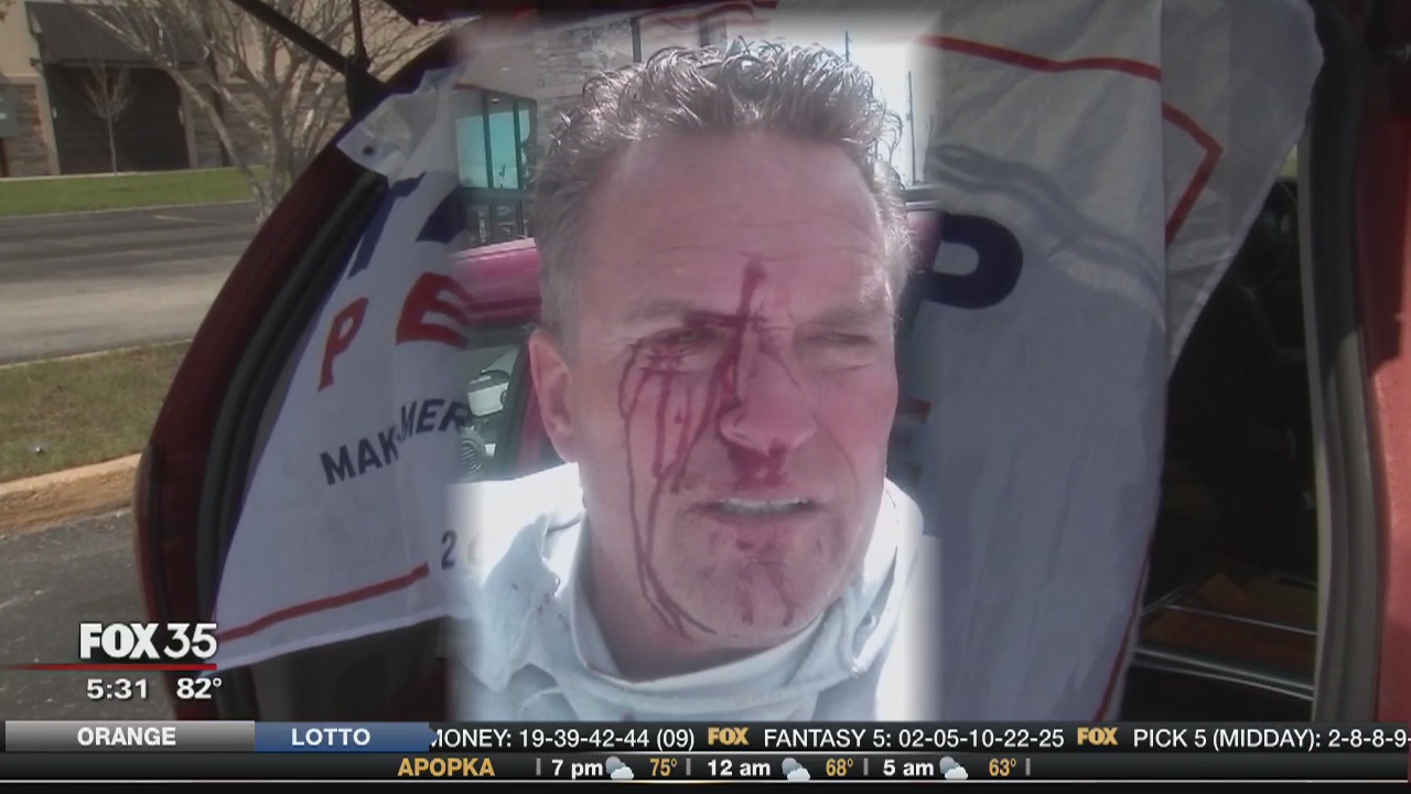 Man says he was attacked for displaying Trump sign