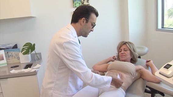 A look at truSculpt iD, a 15-minute body sculpting treatment