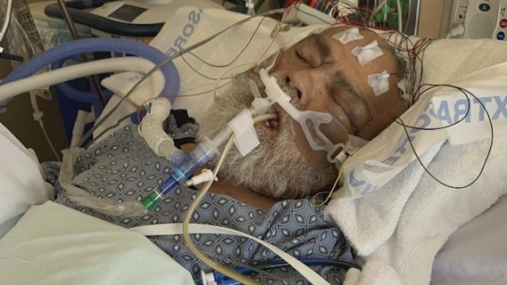 Patient goes into coma and dies after beaten to death