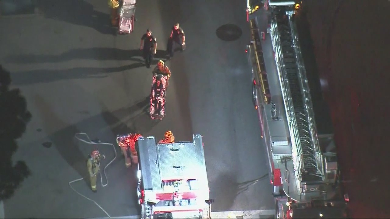 UCLA student hurt in hazmat incident