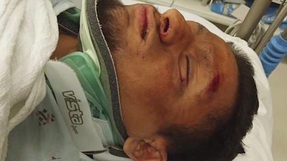 Hit-and-run survivor wants driver to come forward