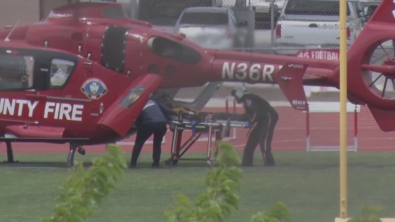 Toddler bitten by rattlesnake while in backyard