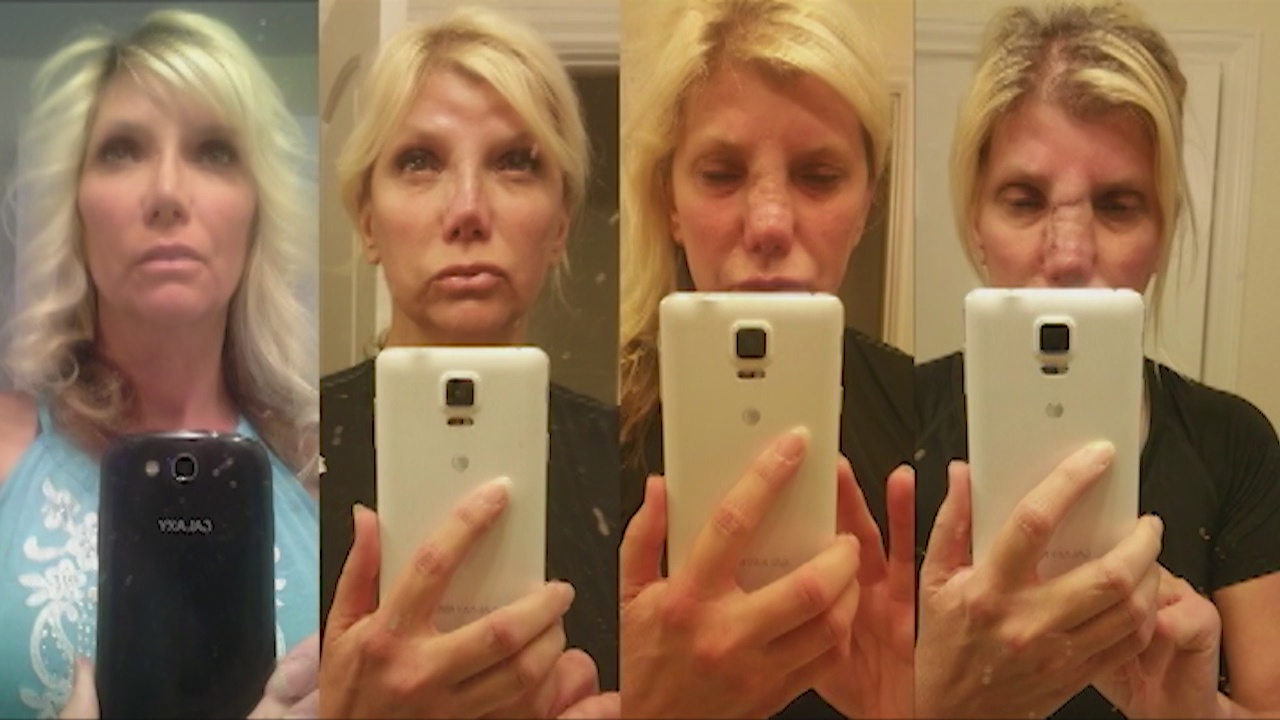 New alleged victims of local plastic surgeon coming forward