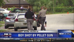 Boy shot in head with pellet gun