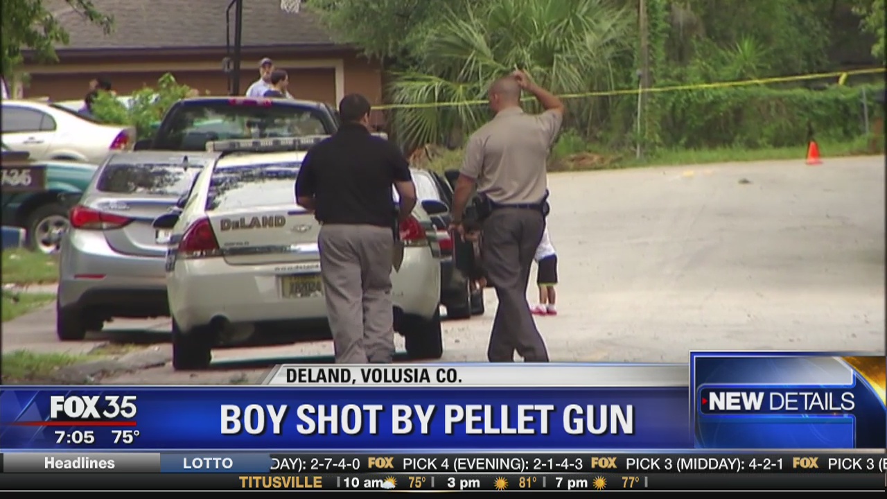 Boy shot in head with pellet gun