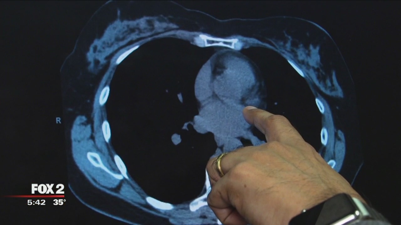 Scoring your calcium levels can give you life-changing news