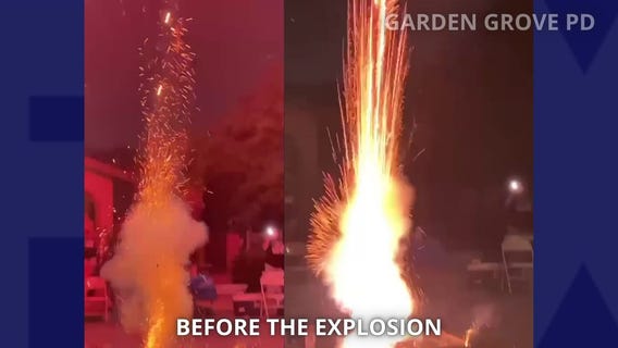 Fireworks explosion injures multiple kids in Garden Grove, police say